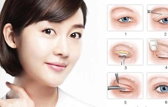  Các loại mí mắt và cách khắc phục nhược điểm cho đôi mắt long lanh